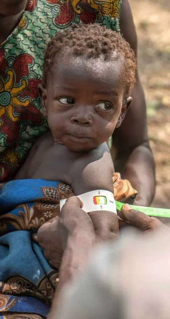 A young baby being treated by a doctor in a village in Africa.